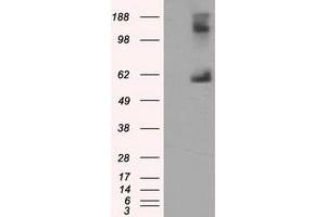 Image no. 1 for anti-Lipase, Endothelial (LIPG) antibody (ABIN1499167)