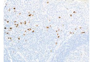 Immunohistochemistry (IHC) image for anti-CD80 (CD80) (AA 35-246) antibody (ABIN7449415) (Rekombinanter CD80 Antikörper  (AA 35-246))