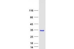 Western Blotting (WB) image for SCAN Domain Containing 1 (SCAND1) (Transcript Variant 2) protein (Myc-DYKDDDDK Tag) (ABIN2731438)