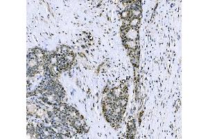 IHC analysis of CSNK2B using anti-CSNK2B antibody (ABIN7599092). (CSNK2B Antikörper  (AA 1-215))