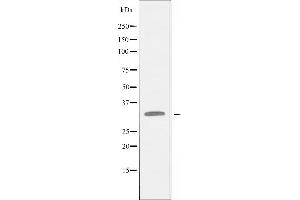 Western blot analysis of extracts from HepG2 cells using RPL5 antibody. (RPL5 Antikörper  (C-Term))