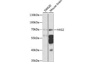 Western blot analysis of extracts of various cell lines, using H antibody (ABIN6129690, ABIN6141613, ABIN6141614 and ABIN6225245) at 1:1000 dilution. (HAS2 Antikörper  (AA 67-185))