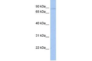 WB Suggested Anti-ATXN7L2 Antibody Titration: 0. (ATXN7L2 Antikörper  (Middle Region))