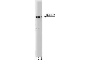 Western blot analysis of Gelsolin on human endothelial cell lysate. (Gelsolin Antikörper  (AA 592-768))