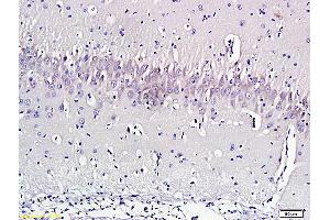 Formalin-fixed and paraffin embedded rat brain labeled with Anti-Nociceptin Polyclonal Antibody, Unconjugated (ABIN724535) 1:300 followed by conjugation to the secondary antibody and DAB staining (Nociceptin Antikörper  (AA 130-146))