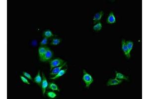 Immunofluorescent analysis of HepG2 cells using ABIN7144495 at dilution of 1:100 and Alexa Fluor 488-congugated AffiniPure Goat Anti-Rabbit IgG(H+L) (Aquaporin 1 Antikörper  (AA 2-269))