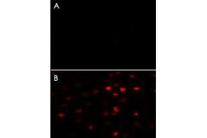 A : Negative control of HeLa cells without Alexa-Fluor-546-conjugated donkey anti-rabbit lgG (H+L). (PKM2 Antikörper  (AA 483-513))
