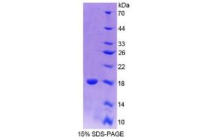 SDS-PAGE (SDS) image for Paired Box 6 (PAX6) (AA 1-130) protein (His tag) (ABIN6237553) (PAX6 Protein (AA 1-130) (His tag))