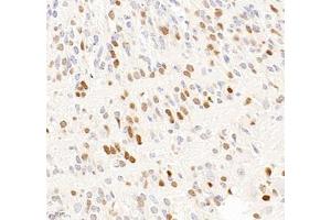 Immunohistochemistry of paraffin embedded mouse embryonic mouse using OTX2 (ABIN7074952) at dilution of 1:600 (400x lens) (OTX2 Antikörper)