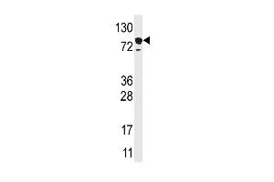 Western blot analysis of anti-EPS15 Pab (ABIN388933 and ABIN2839202) in HL60 cell line lysate (35 μg/lane). (EPS15 Antikörper  (C-Term))