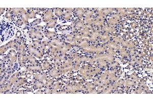 Detection of MAP2K7 in Mouse Kidney Tissue using Polyclonal Antibody to Mitogen Activated Protein Kinase Kinase 7 (MAP2K7) (MAP2K7 Antikörper  (AA 113-388))