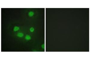Immunofluorescence analysis of HepG2 cells, using SIX6 antibody. (SIX Homeobox 6 Antikörper  (Internal Region))