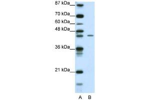WB Suggested Anti-ZNF17 Antibody Titration: 0. (ZNF17 Antikörper  (N-Term))