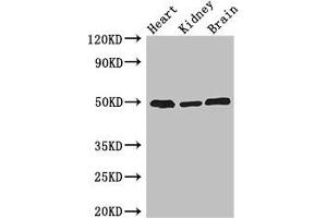 Western Blot Positive WB detected in: Mouse heart tissue, Mouse kidney tissue, Mouse brain tissue All lanes: ANKRD10 antibody at 4 μg/mL Secondary Goat polyclonal to rabbit IgG at 1/50000 dilution Predicted band size: 45, 24 kDa Observed band size: 50 kDa (ANKRD1 Antikörper  (AA 1-220))