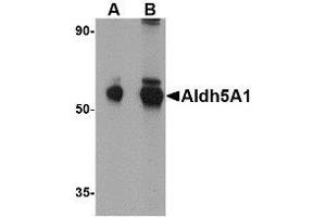Western blot analysis of Aldh5A1 in mouse liver lysate with AP30045PU-N Aldh5A1 antibody at (A) 1 and (B) 2 μg/ml. (ALDH5A1 Antikörper  (C-Term))