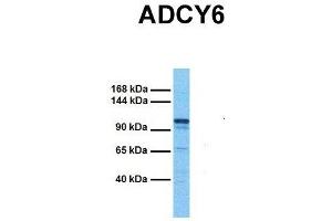 Host:  Rabbit  Target Name:  ADCY6  Sample Tissue:  Human Fetal Kidney  Antibody Dilution:  1. (ADCY6 Antikörper  (C-Term))