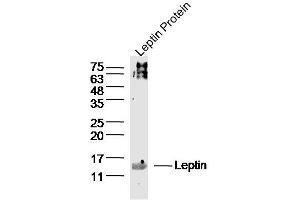 Leptin lysates probed with Leptin Polyclonal Antibody, Unconjugated  at 1:300 dilution and 4˚C overnight incubation. (Leptin Antikörper  (AA 17-100))