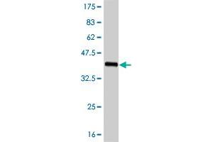 Western Blot detection against Immunogen (37. (FOXC2 Antikörper  (AA 156-256))