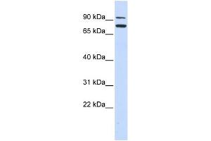 WB Suggested Anti-ZNF440 Antibody Titration:  0. (ZNF440 Antikörper  (Middle Region))