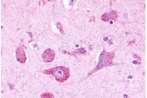 Immunohistochemical staining of human brain, neurons with LPHN3 polyclonal antibody . (LPHN3 Antikörper  (C-Term))