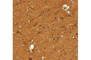 IHC analysis of VCP using anti-VCP antibody (ABIN7599605). (VCP Antikörper  (AA 10-512))