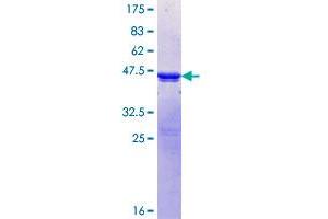 PPP1R3A Protein (AA 3-101) (GST tag)