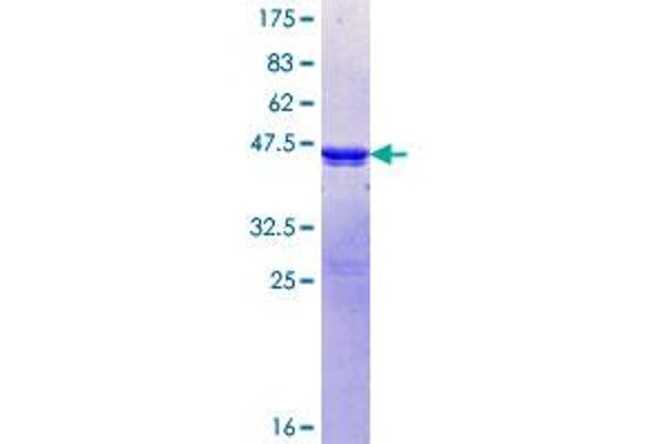 PPP1R3A Protein (AA 3-101) (GST tag)