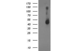 Western Blotting (WB) image for anti-Ganglioside-Induced Differentiation-Associated Protein 1-Like 1 (GDAP1L1) antibody (ABIN1498421) (GDAP1L1 Antikörper)