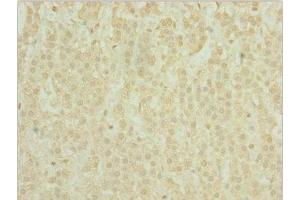 Immunohistochemistry of paraffin-embedded human adrenal gland tissue using ABIN7163721 at dilution of 1:100 (POC1A Antikörper  (AA 138-407))