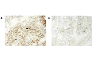 Immunohistochemical staining of bioptic sections of small intestine using anti-NLRP6/NALP6 (human), mAb (Clint-1)  at 1:500 dilution. (NLRP6 Antikörper)