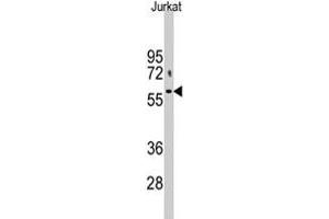 Western blot analysis of PFKFB1 polyclonal antibody  in Jurkat cell lysate (35 ug/lane). (PFKFB1 Antikörper  (N-Term))