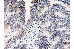 Image no. 7 for anti-Adenylate Kinase 4 (AK4) antibody (ABIN1496525)