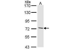 WB Image Sample (30 ug of whole cell lysate) A: Hela 7. (DYNC1I2 Antikörper)