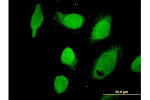 Immunofluorescence of purified MaxPab antibody to CAPN1 on HeLa cell. (CAPNL1 Antikörper  (AA 1-714))