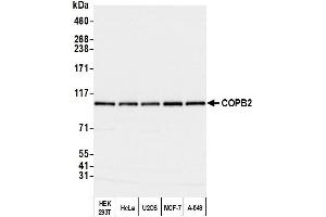 Western Blotting (WB) image for anti-Coatomer Protein Complex, Subunit beta 2 (COPB2) (AA 856-906) antibody (ABIN7453569) (COPB2 Antikörper  (AA 856-906))