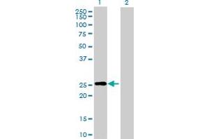 Western Blot analysis of RND3 expression in transfected 293T cell line by RND3 MaxPab polyclonal antibody. (RND3 Antikörper  (AA 1-244))