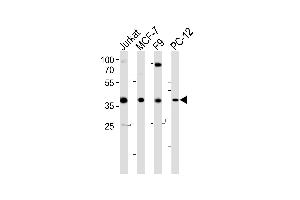 Western blot analysis of lysates from Jurkat, MCF-7, F9, PC-12 cell line (from left to right), using human-FOSL2 (Y83) (ABIN6243663 and ABIN6577541). (FOSL2 Antikörper  (AA 70-110))