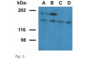 Western Blotting (WB) image for anti-Ubinuclein 1 (UBN1) (AA 1-190), (N-Term) antibody (ABIN614815) (Ubinuclein 1 Antikörper  (N-Term))
