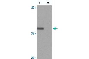 Western blot analysis of PRICKLE4 in A-549 cell lysate with PRICKLE4 polyclonal antibody  at 0. (PRICKLE4 Antikörper  (N-Term))