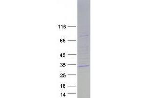 Validation with Western Blot (STAR Protein (Transcript Variant 1) (Myc-DYKDDDDK Tag))