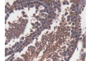 DAB staining on IHC-P; Samples: Mouse Testis Tissue (TLR1 Antikörper  (AA 25-134))