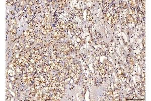 IHC analysis of Sorbitol Dehydrogenase/SORD using anti-Sorbitol Dehydrogenase/SORD antibody (ABIN7602485). (SORD Antikörper  (AA 8-357))