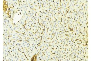 ABIN6269022 at 1/100 staining Mouse liver tissue by IHC-P. (VDAC1 Antikörper  (C-Term))