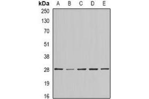 Western blot analysis of BAP29 expression in SKOV3 (A), MCF7 (B), mouse testis (C), mouse brain (D), rat heart (E) whole cell lysates.