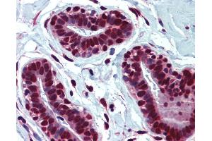 IHC Information: Paraffin embedded breast tissue, tested with an antibody dilution of 5 ug/ml. (HNRNPC Antikörper  (Middle Region))