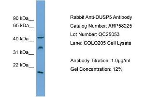 WB Suggested Anti-DUSP5  Antibody Titration: 0. (DUSP5 Antikörper  (Middle Region))