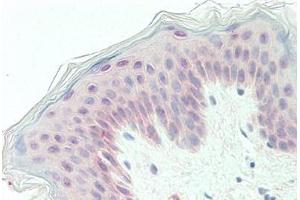 Human Skin: Formalin-Fixed, Paraffin-Embedded (FFPE) (GPC1 Antikörper  (Internal Region))