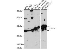 Western blot analysis of extracts of various cell lines, using GPD1L antibody (ABIN7267460) at 1:3000 dilution. (GPD1L Antikörper  (AA 1-351))