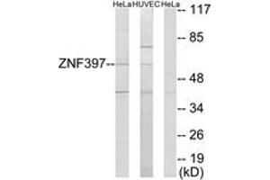 Western blot analysis of extracts from HeLa/HuvEc cells, using ZNF397 Antibody.