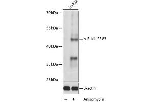 Western blot analysis of extracts of Jurkat cells, using Phospho-ELK1-S383 antibody (ABIN3019475, ABIN3019476, ABIN3019477 and ABIN6225392) at 1:1000 dilution. (ELK1 Antikörper  (pSer383))